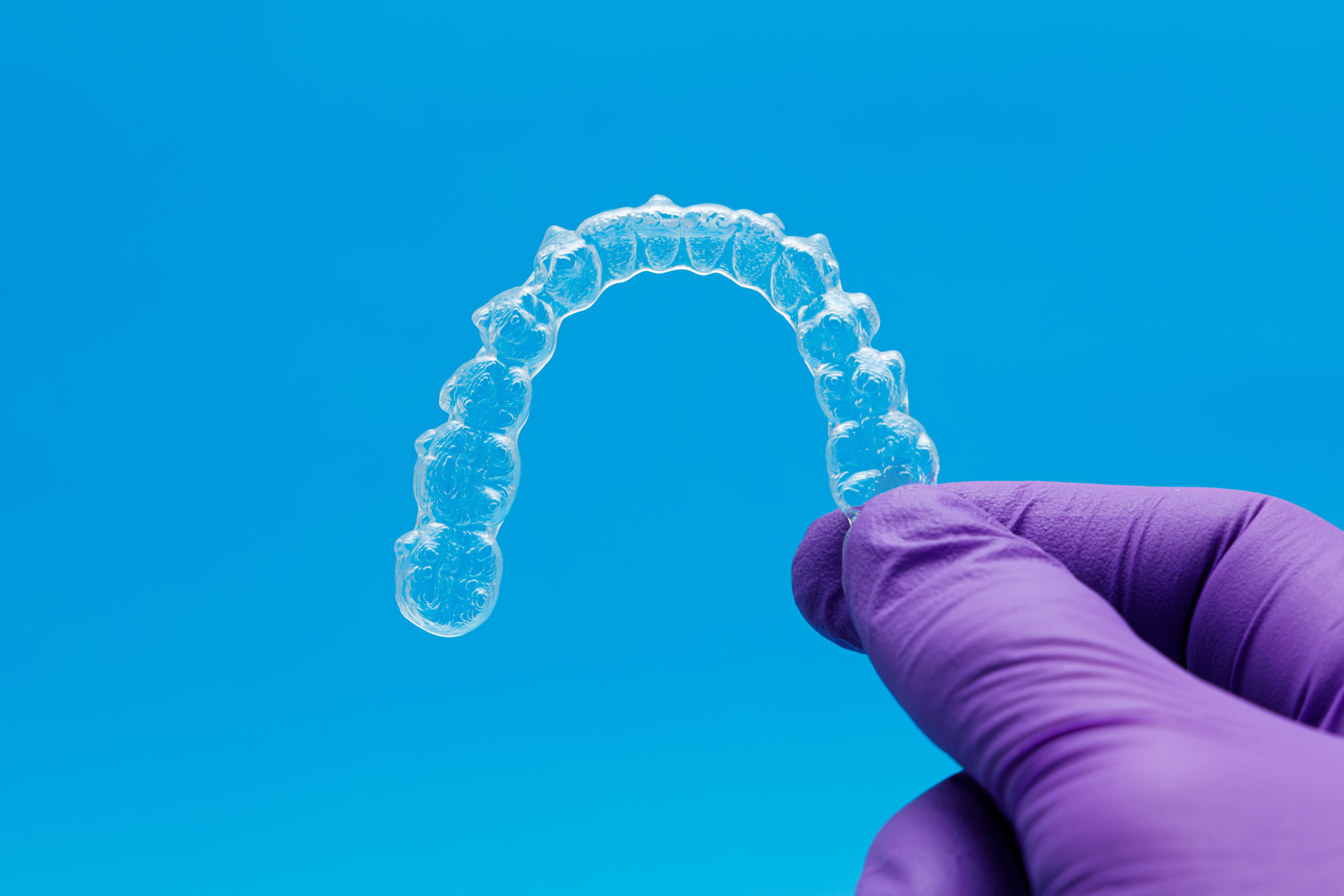 can-invisalign-correct-an-overbite